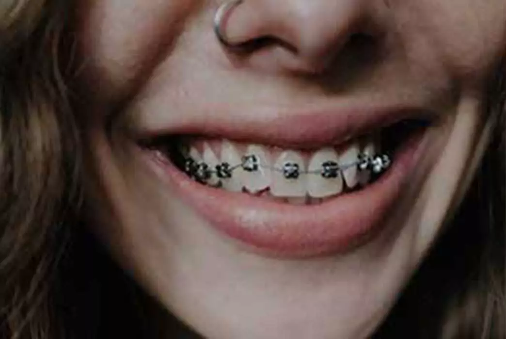 teeth Orthodontics